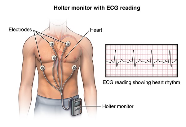 holter